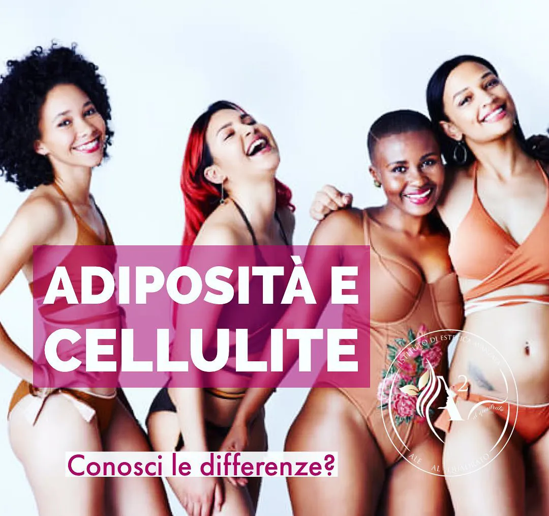 Centro di estetica avanzata Ale al Quadrato | La differenza fra adiposità e cellulite Qual è la differenza fra la cellulite e l'adiposità? | Centro estetico Ale al Quadrato
